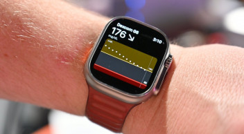 Sugar Tracking with Apple Watches May Come Soon Dexcom G7 Can Be Connected to Apple Watch